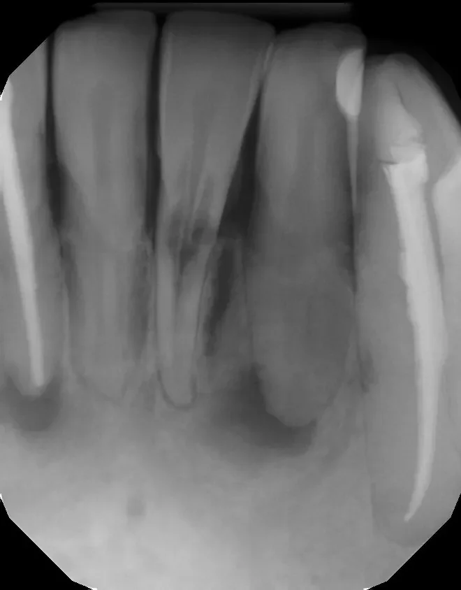 Dental X-ray imaging